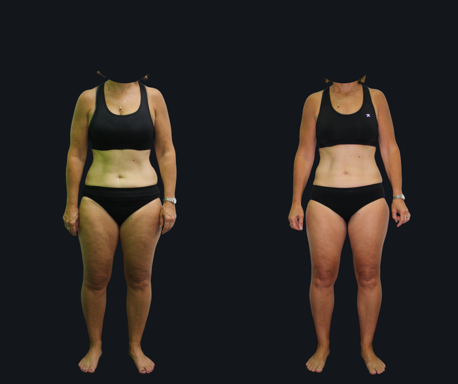 6X Training member transformation 11 - before and after 6 weeks