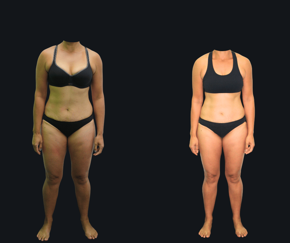 6X Training member transformation 16 - before and after 6 weeks