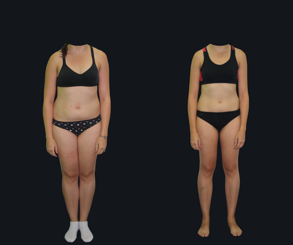 6X Training member transformation 3 - before and after 6 weeks