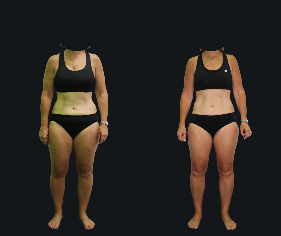 6X Training member transformation 11 - before and after 6 weeks