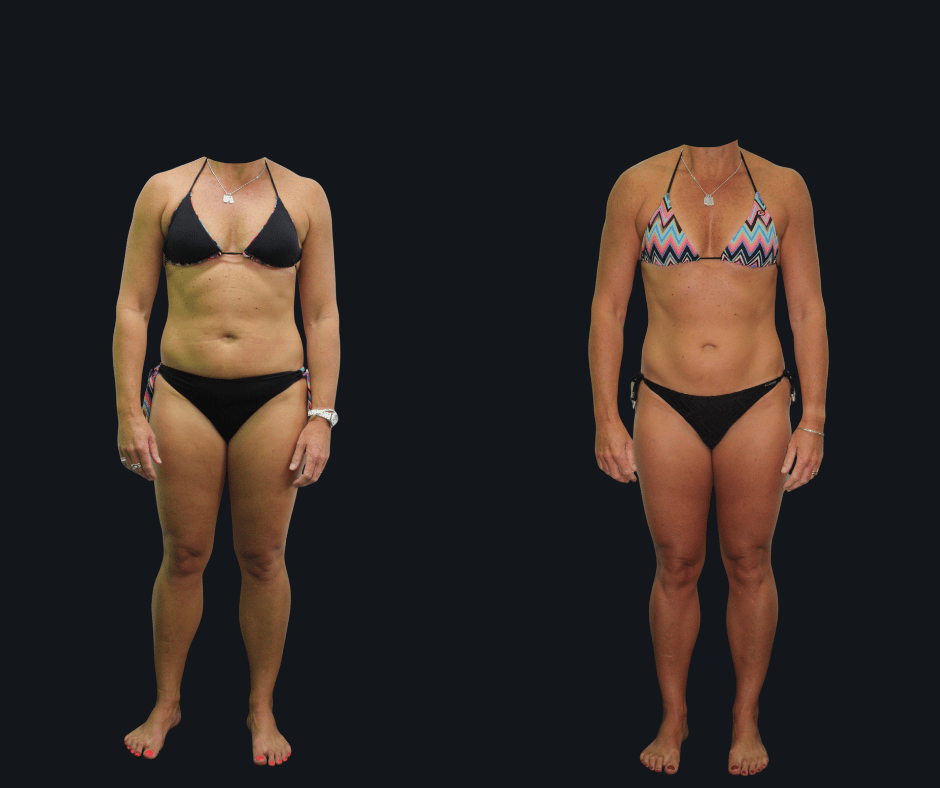 6X Training member transformation 17 - before and after 6 weeks