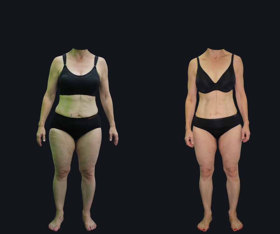 6X Training member transformation 1 - before and after 6 weeks